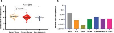 Expression of microRNA-379 reduces metastatic spread of prostate cancer